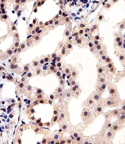 IHC-P - CSNK2A1 Antibody (Center) AW5043-U100